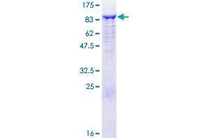 GCLC Protein (AA 1-637) (GST tag)