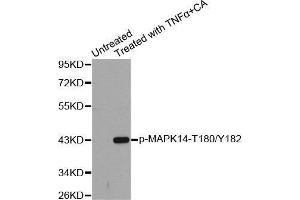 Western blot analysis of extracts from Hela cells using Phospho-MAPK14-T180/Y182 antibody. (MAPK14 antibody  (pThr180, pTyr182))