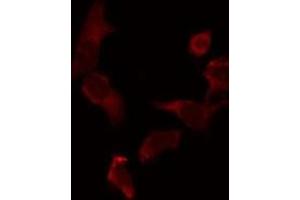 ABIN6275344 staining 293 by IF/ICC. (PECI/ECI2 antibody  (Internal Region))