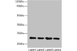 Western blot All lanes: HPCAL4 antibody at 2 μg/mL Lane 1: Mouse brain tissue Lane 2: Mouse kidney tissue Lane 3: Mouse ovarian tissue Lane 4: Human placenta tissue Secondary Goat polyclonal to rabbit IgG at 1/10000 dilution Predicted band size: 22 kDa Observed band size: 22 kDa (HPCAL4 antibody  (AA 2-191))