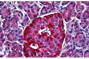 Human Pancreas, Islets of Langerhans: Formalin-Fixed, Paraffin-Embedded (FFPE) (STXBP1 antibody  (AA 74-169))