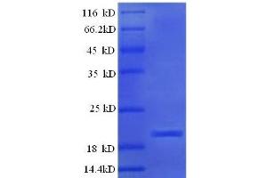 SDS-PAGE (SDS) image for Ephrin A5 (EFNA5) (AA 21-203), (full length) protein (His tag) (ABIN7479012)