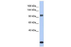 ATXN7 antibody used at 1. (ATXN7 antibody  (Middle Region))