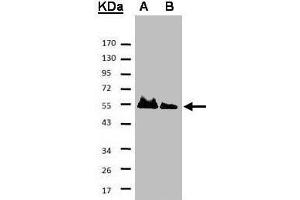 Western blot analysis of A: His-Hice1 (2x); B: His-Hice1 (1x) using a 7. (NYS48/HAUS8 antibody)