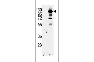Western blot analysis of PI3KCG Antibody Pab using purified Pab using 293 cell lysates (2 ug/lane) either nontransfected (Lane 1) or transiently transfected with the PI3KCG gene (Lane 2).