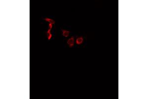 ABIN6266452 staining A549 cells by IF/ICC. (EPHA2/3/4 antibody  (pTyr588, pTyr596))