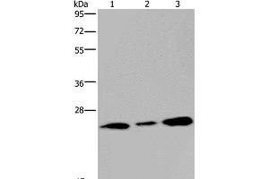 Western Blot analysis of Human fetal brain tissue and 293T cell using RAB3c Polyclonal Antibody at dilution of 1:400