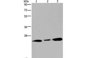 Western Blot analysis of Human fetal brain tissue and 293T cell using RAB3c Polyclonal Antibody at dilution of 1:400 (Rab3c antibody)
