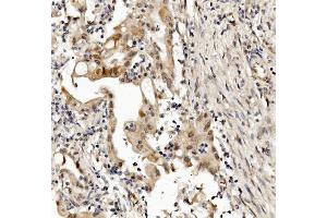IHC analysis of MED4 using anti-MED4 antibody (ABIN7600817). (MED4 antibody  (AA 24-254))
