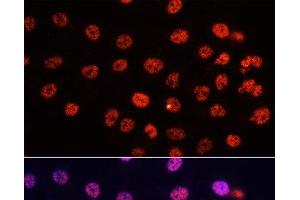Immunofluorescence analysis of HeLa cells using DiMethyl-Histone H3-K4 Polyclonal Antibody at dilution of 1:100. (Histone 3 antibody  (2meLys4))