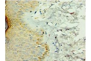 Immunohistochemistry of paraffin-embedded human skin tissue using ABIN7156908 at dilution of 1:100 (FIL1d antibody  (AA 1-155))