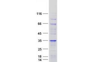 Validation with Western Blot (ODF3 Protein (Myc-DYKDDDDK Tag))