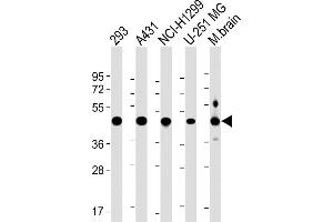 All lanes : Anti-NSFL1C Antibody (Center) at 1:2000 dilution Lane 1: 293 whole cell lysate Lane 2: A431 whole cell lysate Lane 3: NCI- whole cell lysate Lane 4: U-251 MG whole cell lysate Lane 5: Mouse brain lysate Lysates/proteins at 20 μg per lane. (NSFL1C antibody  (AA 214-248))