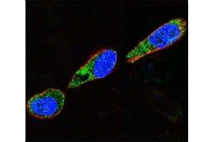 Confocal immunofluorescent analysis of Src antibody with A375 cells followed by Alexa Fluor 488-conjugated goat anti-rabbit lgG (green). (Src antibody  (AA 397-424))