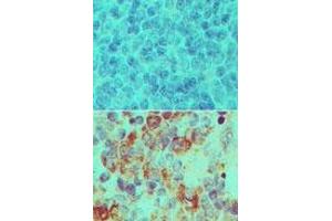 Image no. 1 for anti-Importin 7 (IPO7) (AA 1-50) antibody (ABIN960236) (IPO7 antibody  (AA 1-50))