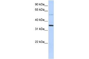 Transfected 293T; WB Suggested Anti-ANKRD9 Antibody Titration: 0. (ANKRD9 antibody  (Middle Region))