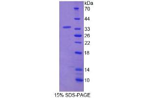 SDS-PAGE analysis of Human NASP Protein. (NASP Protein)