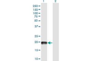 Western Blot analysis of MAP4 expression in transfected 293T cell line by MAP4 monoclonal antibody (M03), clone 7C9. (MAP4 antibody  (AA 1-99))