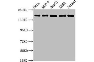 Western Blot Positive WB detected in: Hela whole cell lysate, MCF-7 whole cell lysate, HepG2 whole cell lysate, K562 whole cell lysate, Jurkat whole cell lysate All lanes: HDAC6 antibody at 1. (Recombinant HDAC6 antibody)