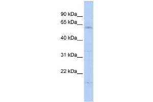 Western Blotting (WB) image for anti-F-Box and WD Repeat Domain Containing 11 (FBXW11) antibody (ABIN2458711)