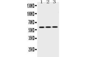 Western blot analysis of EPHX2 expression in rat lung extract ( Lane 1), mouse lung extract ( Lane 2) and HEPG2 whole cell lysates ( Lane 3).