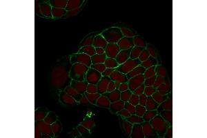 Immunofluorescence (IF) image for anti-Epithelial Cell Adhesion Molecule (EPCAM) (AA 77-202), (Extracellular Domain) antibody (ABIN6939980)