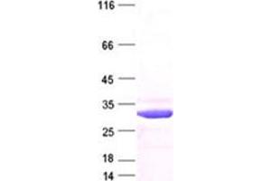 Validation with Western Blot (CDKN1B Protein (DYKDDDDK Tag))