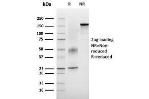 SDS-PAGE Analysis Purified VISTA Monospecific Mouse Monoclonal Antibody (VISTA/3007). (VISTA antibody)