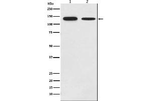 Western blot analysis of Growth hormone receptor expression in (1) MCF-7 cell lysate, (2) Mouse brain lysate.