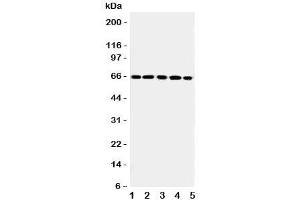 Western blot testing of RGS14 antibody and Lane 1:  rat thymus;  2: (r) spleen;  3: human Raji;  4: (h) CEM;  5: (h) Jurkat cell lysate.