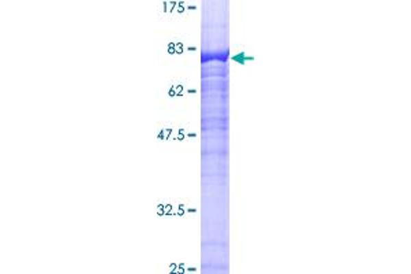 RGS14 Protein (AA 1-566) (GST tag)