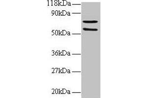 Western blot All lanes: SDHA antibody at 2 μg/mL + 293T whole cell lysate Secondary Goat polyclonal to rabbit IgG at 1/15000 dilution Predicted band size: 73, 68, 57 kDa Observed band size: 73, 57 kDa (SDHA antibody  (AA 44-293))