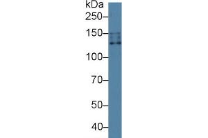 Western Blotting (WB) image for Solute Carrier Family 12 (Sodium/Chloride Transporters), Member 3 (SLC12A3) ELISA Kit (ABIN6720503)