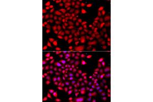 Immunofluorescence analysis of A549 cells using RARG antibody (ABIN5975541). (Retinoic Acid Receptor gamma antibody)