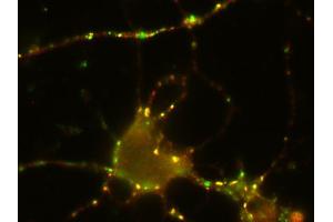 Immunostaining of rat hippocampus neurons with anti-SV2 C (red; dilution: 1 : 500) and anti-synaptophysin (cat.