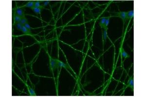 Immunofluorescence (IF) image for anti-Small Nuclear Ribonucleoprotein Polypeptide N (SNRPN) (AA 14-174) antibody (ABIN968086) (SNRPN antibody  (AA 14-174))