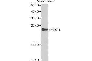 Western blot analysis of extracts of mouse heart cell lines, using VEGFB antibody.