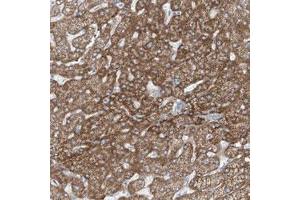 Immunohistochemical staining (Formalin-fixed paraffin-embedded sections) of human liver with TENC1 polyclonal antibody  shows moderate cytoplasmic positivity in hepatocytes. (TENC1 antibody)