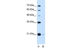 XTP3TPA antibody used at 0. (DCTPP1 antibody  (Middle Region))