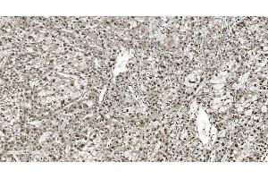 IHC analysis of HNRNPH3 using anti-HNRNPH3 antibody (ABIN7601121). (HNRNPH3 antibody  (AA 29-268))