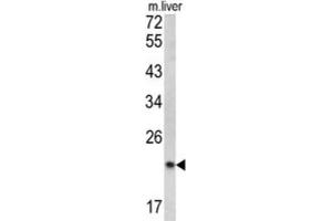 Western Blotting (WB) image for anti-Signal Peptidase Complex Subunit 3 Homolog (SPCS3) antibody (ABIN3002742) (SPCS3 antibody)