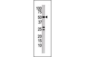 Western blot analysis of anti-P3CB Pab (ABIN392893 and ABIN2842292) in mouse kidney tissue lysate. (PPP3CB antibody  (N-Term))