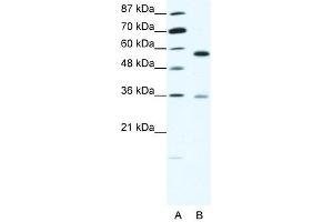 GDI1 antibody (20R-1348) used at 0. (GDI1 antibody  (C-Term))
