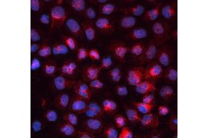 IF analysis of TFRC using anti-TFRC antibody (ABIN3043538).