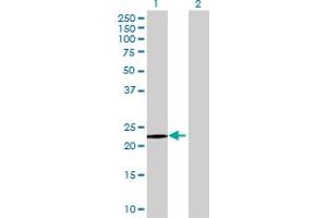 Western Blot analysis of SAP30L expression in transfected 293T cell line ( H00079685-T01 ) by SAP30L MaxPab polyclonal antibody.