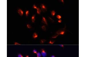 Immunofluorescence analysis of U2OS cells using CYP3A4 Polyclonal Antibody at dilution of 1:100. (CYP3A4 antibody)