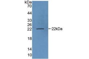 Figure. (LAMP3 antibody  (AA 222-381))