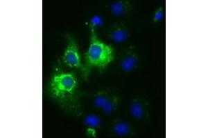 Anti-CYB5R3 mouse monoclonal antibody (ABIN2452925) immunofluorescent staining of COS7 cells transiently transfected by pCMV6-ENTRY CYB5R3 (RC201592). (CYB5R3 antibody)