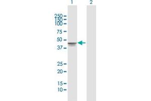 Western Blot analysis of TMOD2 expression in transfected 293T cell line by TMOD2 MaxPab polyclonal antibody.