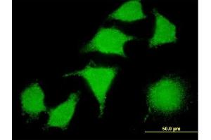 Immunofluorescence of monoclonal antibody to LIMK2 on HeLa cell. (LIMK2 antibody  (AA 1-686))